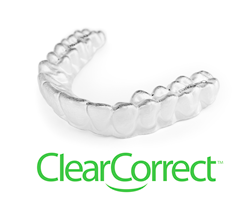 ClearCorrect™ Treatment