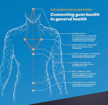 Diagram showing how good gum health can improve overall health.