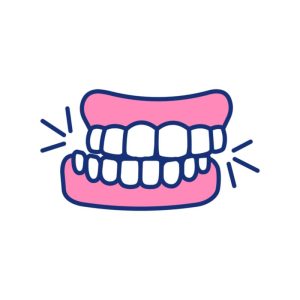 Illustration demonstrating teeth grinding and clenching.