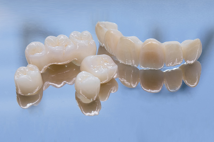three ceramic crowns and two bridges are shown against a blue background