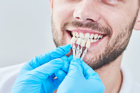 A dentist color-matches restorations with a man's natural teeth.